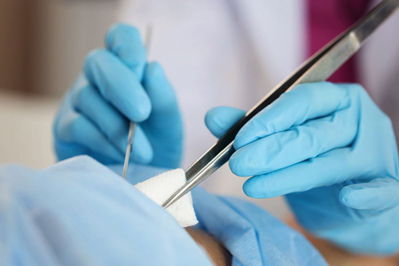 Minor Surgical Procedures